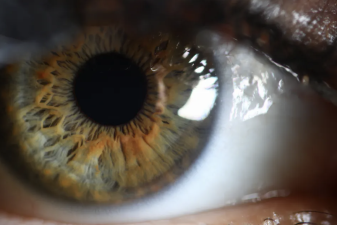 An image of an eye.